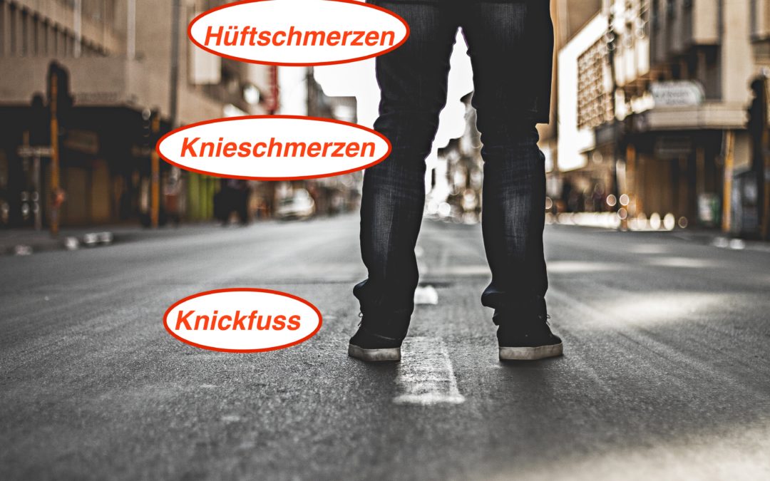 Knickfuss